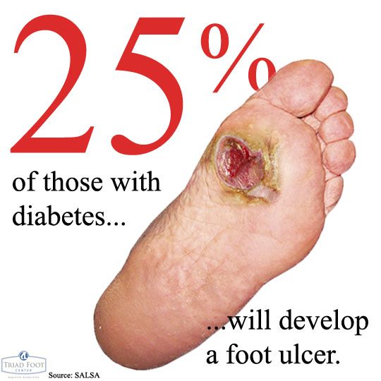 234 best images about Diabetes and Foot Health on ...