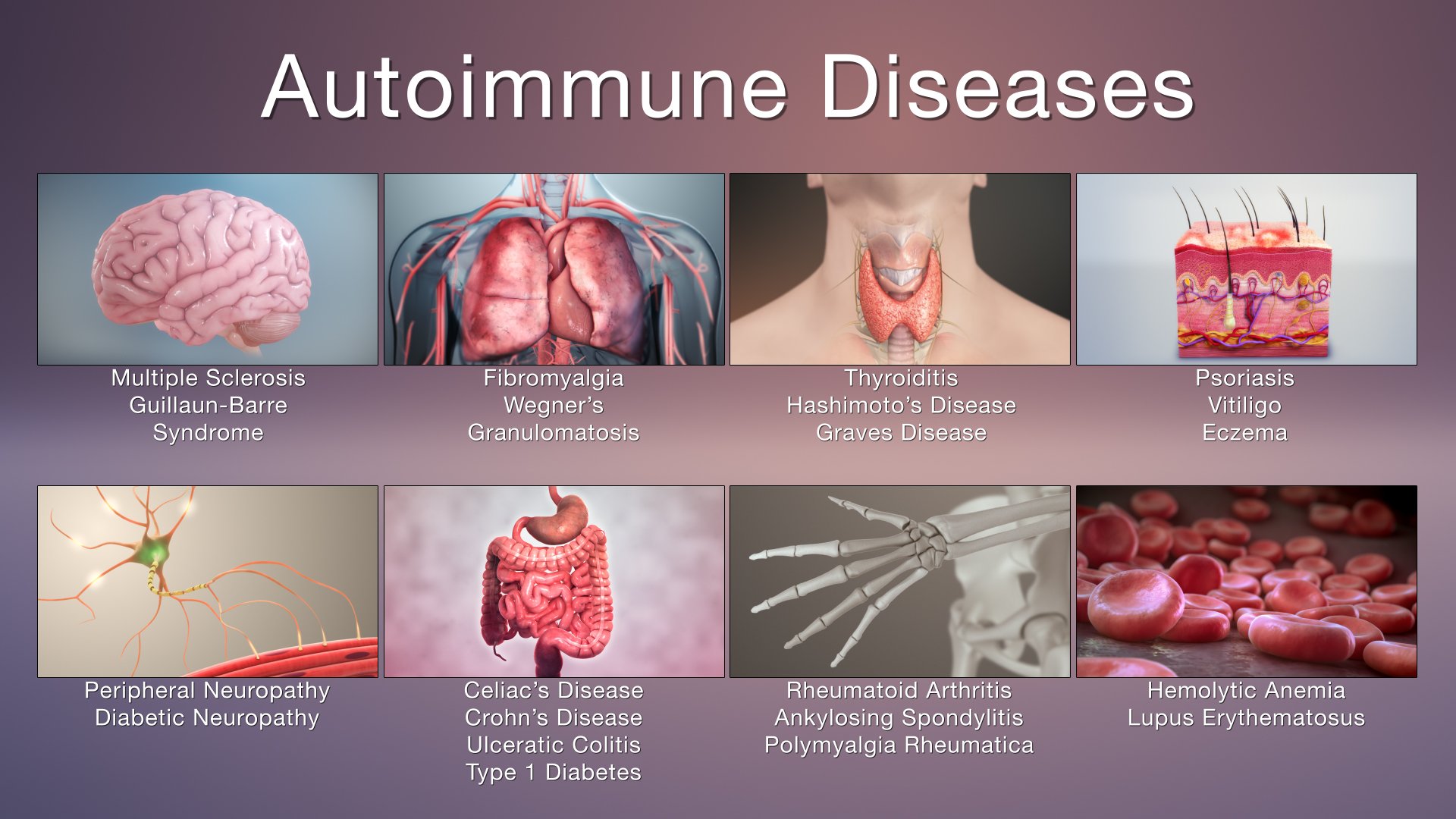 Autoimmune Diseases: Symptoms and Treatments