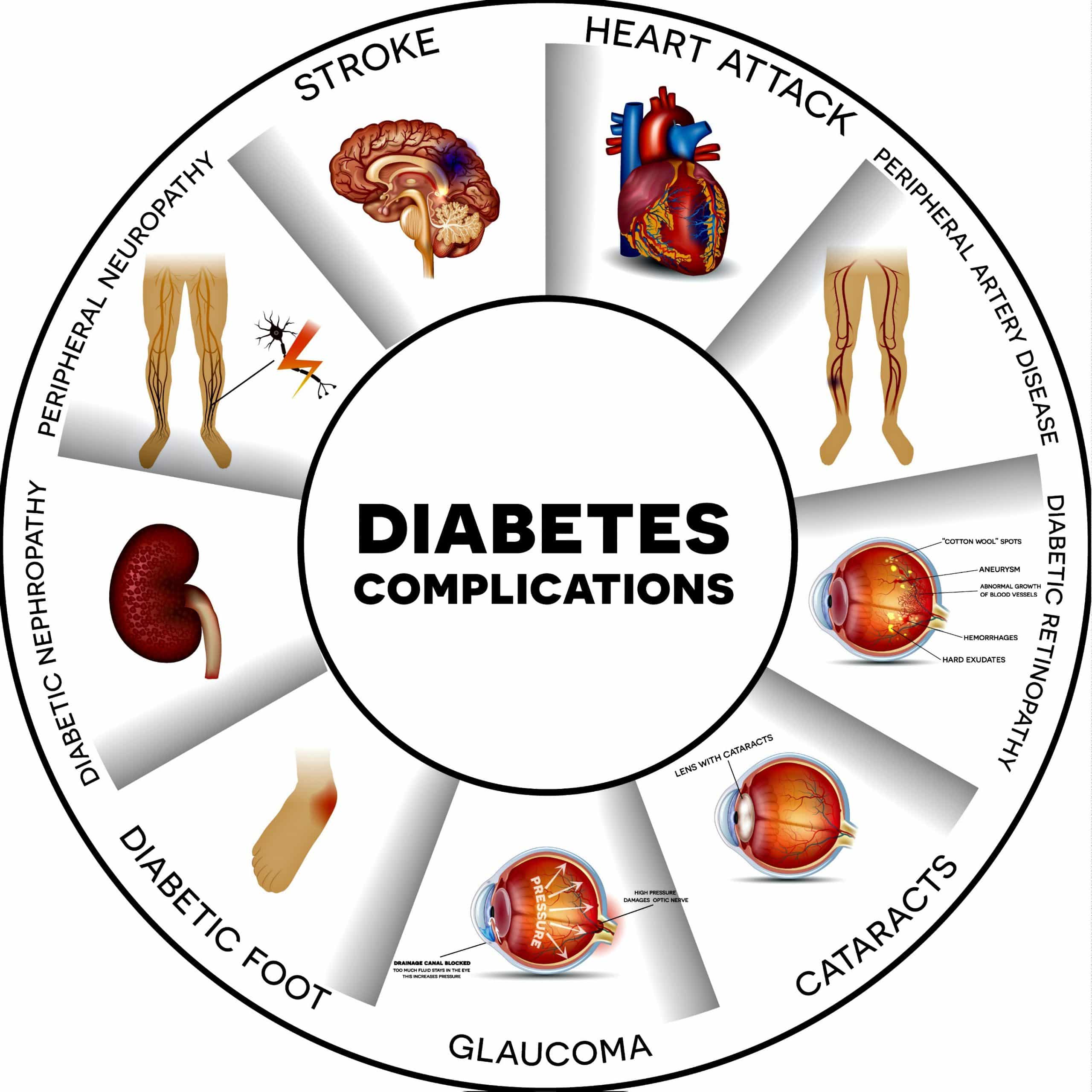CATEGORIES OF DIABETES, SYMPTOMS, CAUSES AND THEIR TREATMENT