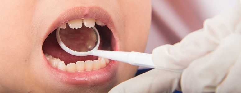 Children with type 2 diabetes more likely to have poor oral health ...
