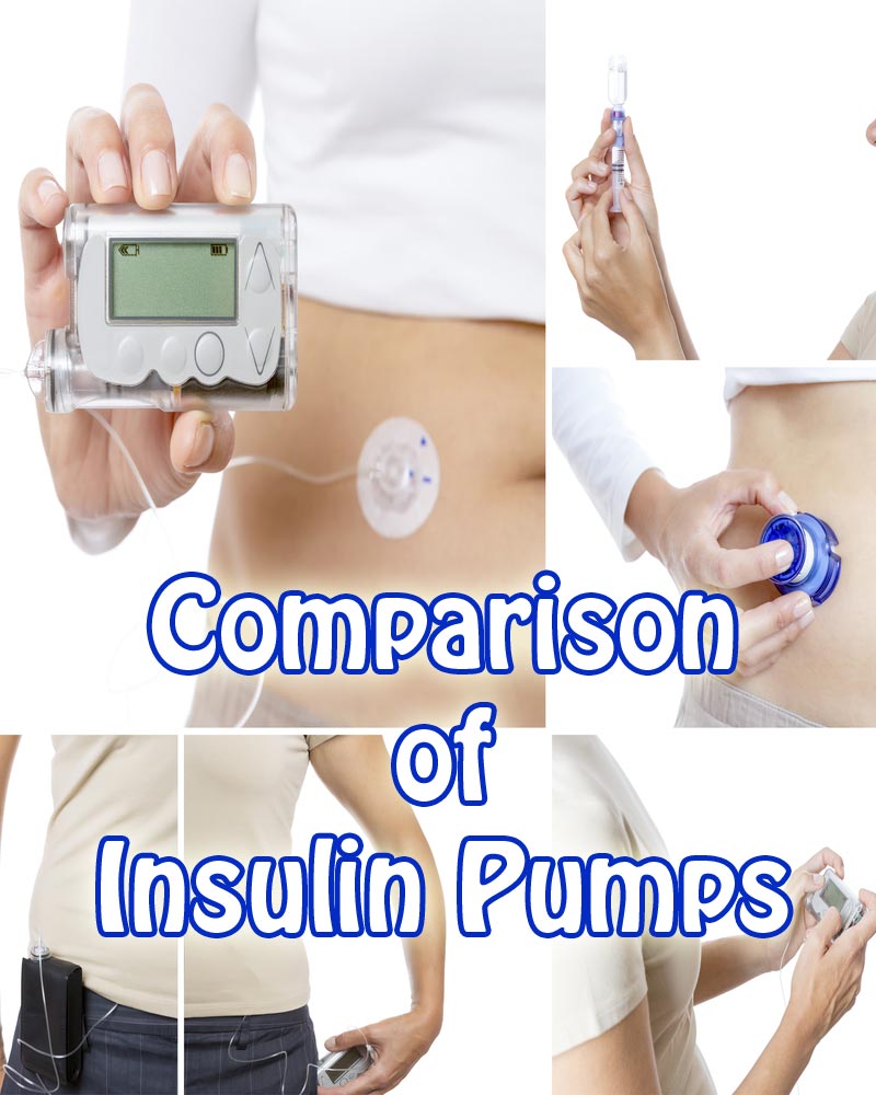 Comparison of Insulin Pumps