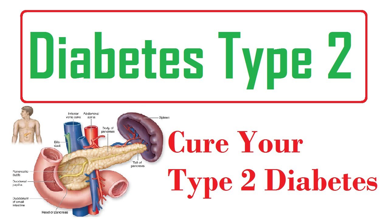 cure for diabetes type 2