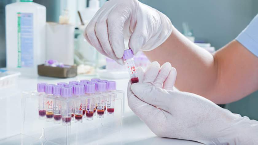 Diabetes: 4 Lab Tests for Diagnosis