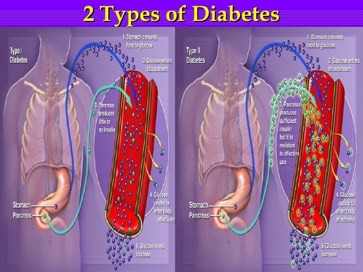 Diabetes affects endocrine system, the diabetic cookbook ...