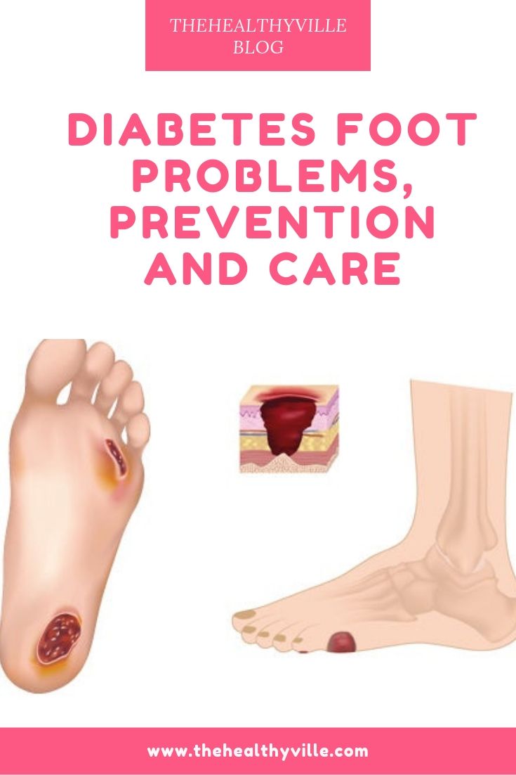 Diabetes Foot Problems, Prevention and Care
