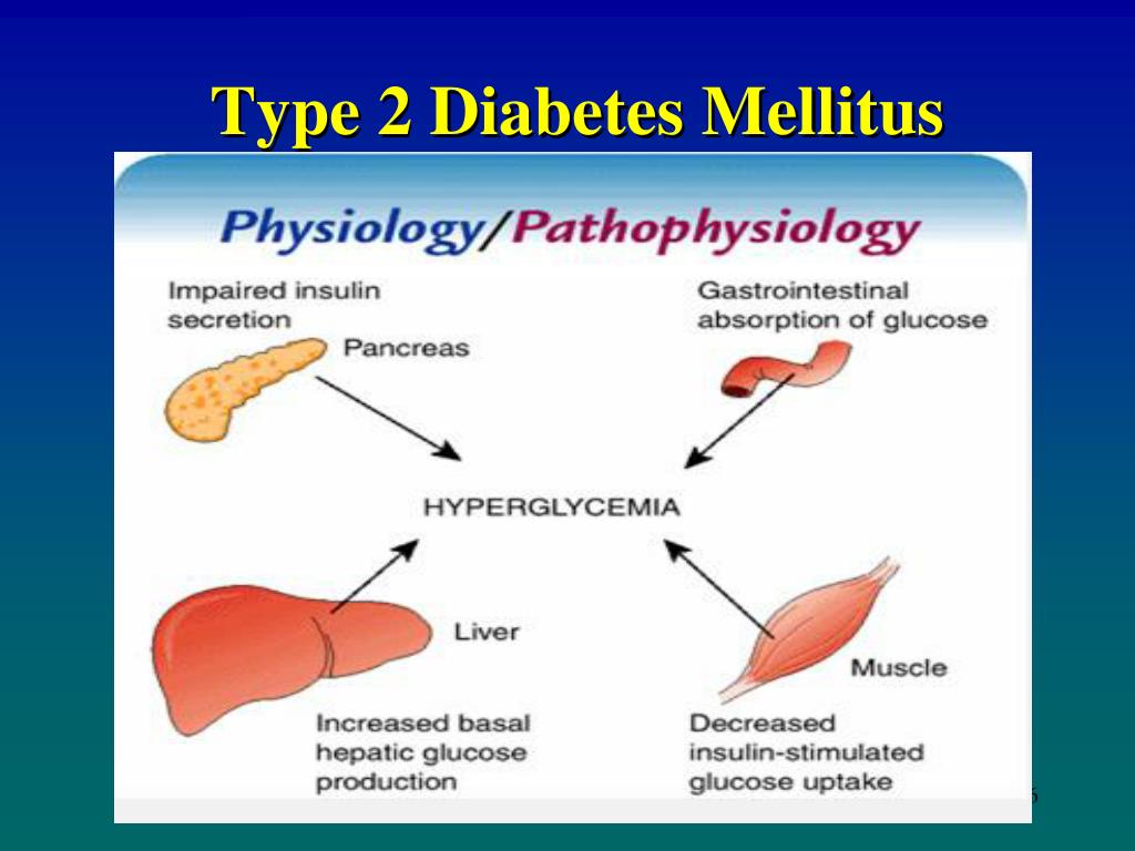 Diabetes Mellitus Type 2