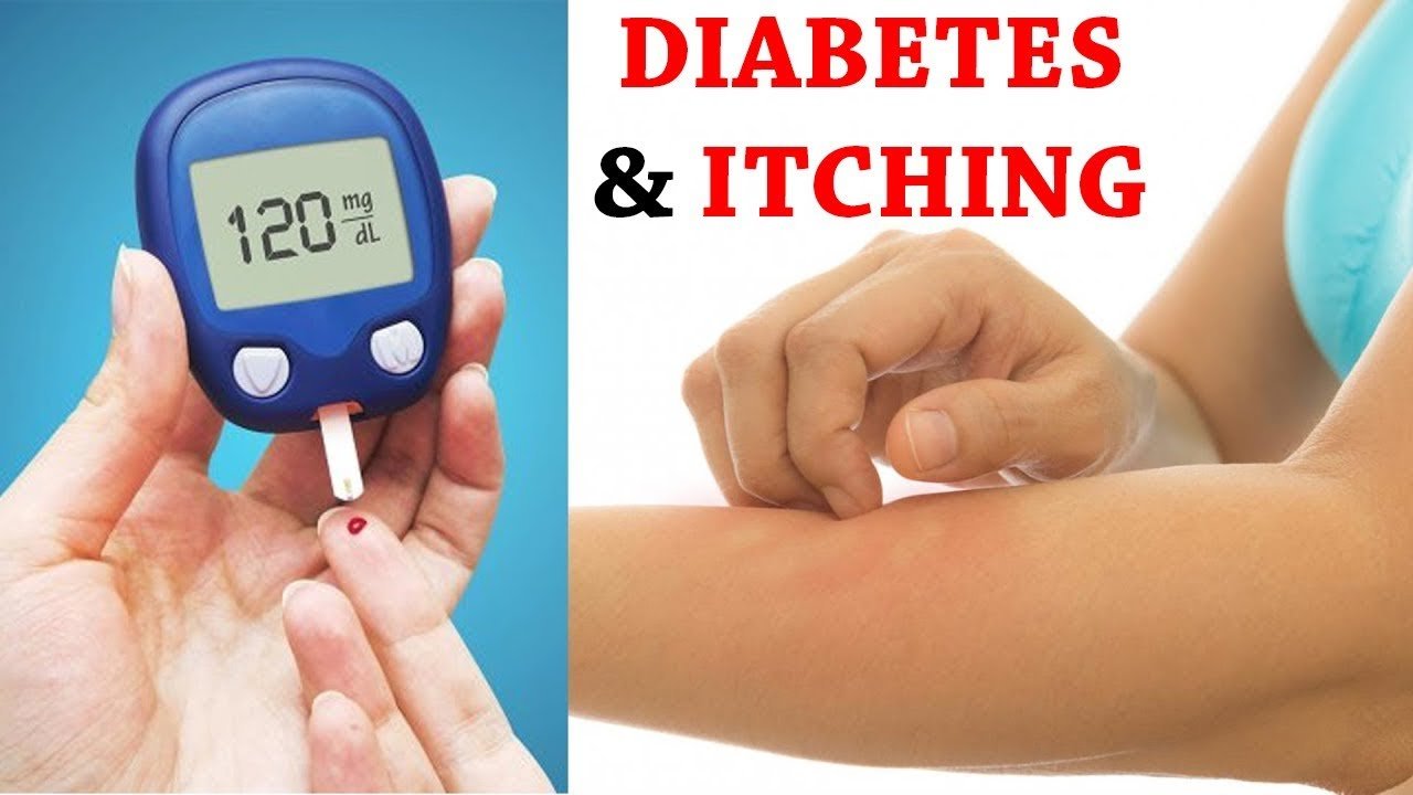 Diabetes: tips to control skin itching