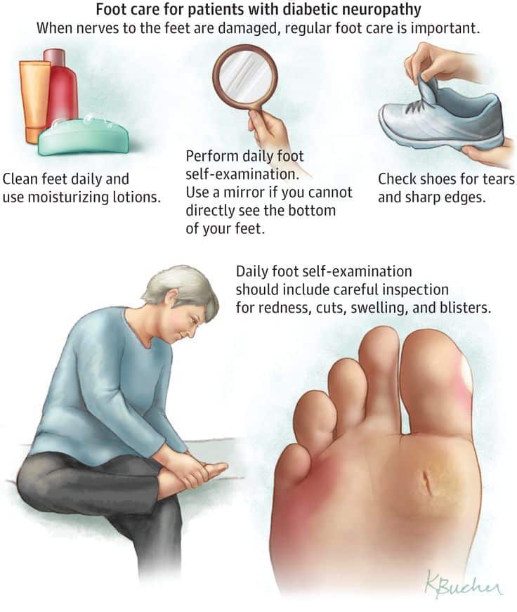 Diabetic Foot Exams