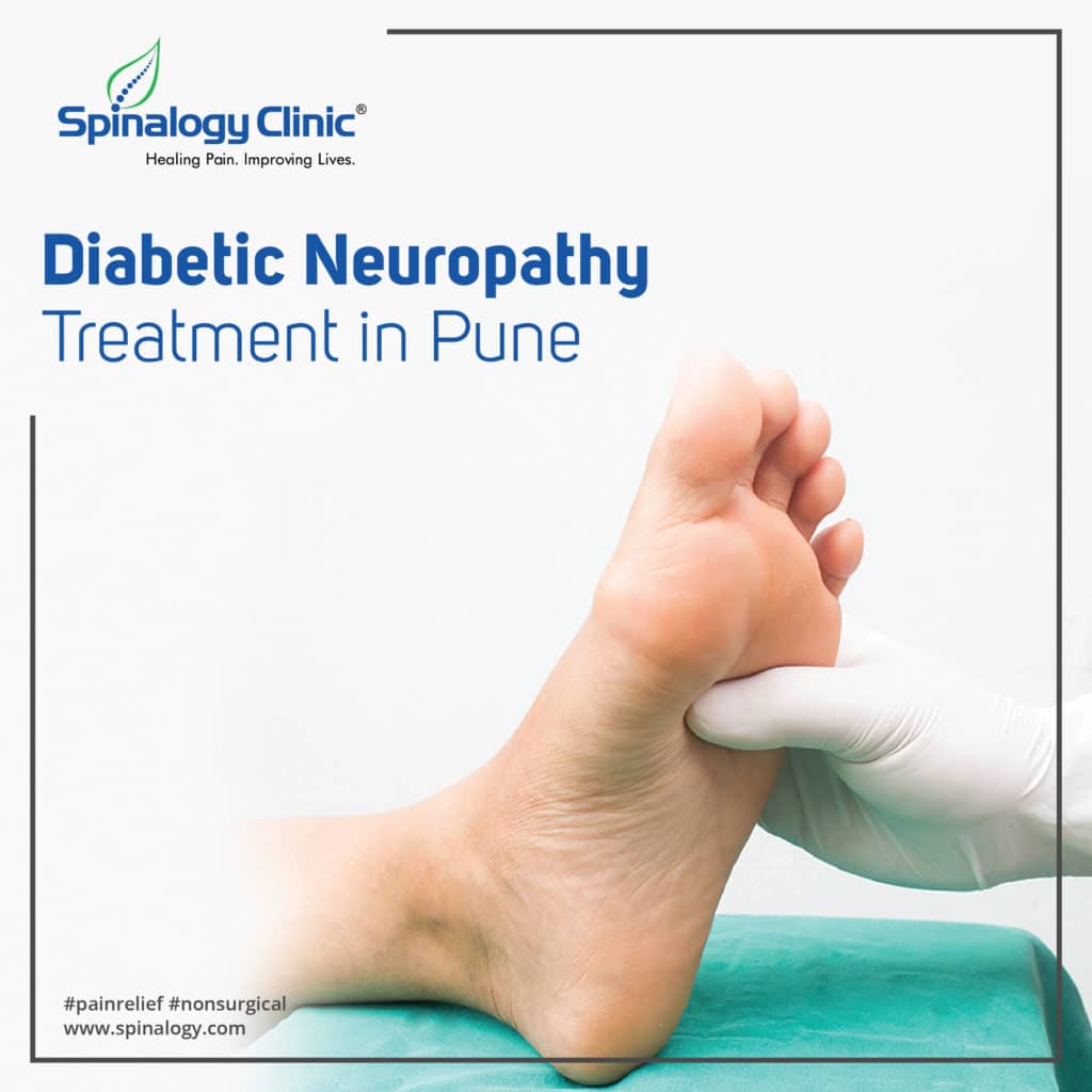 Diabetic Neuropathy Treatment in Pune