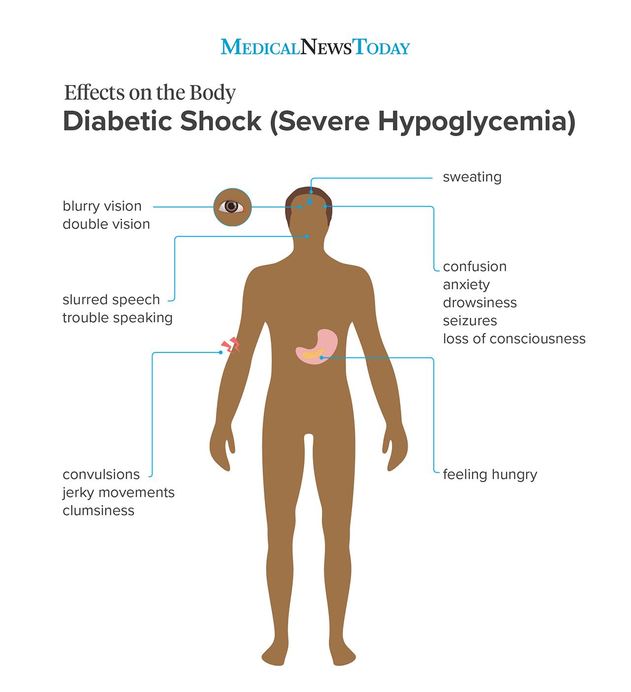Diabetic shock: Symptoms, complications, and treatment