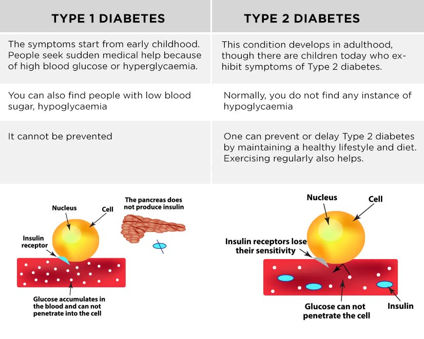 Difference between Type 1 and Type 2 Diabetes and their common symptoms