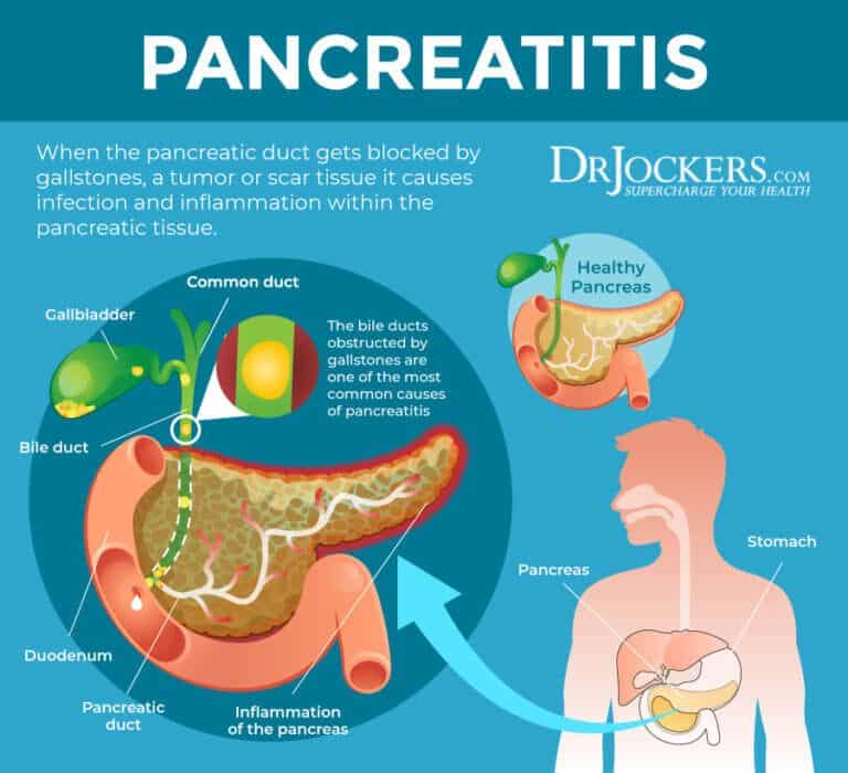 Does Diabetes Cause Pancreatitis