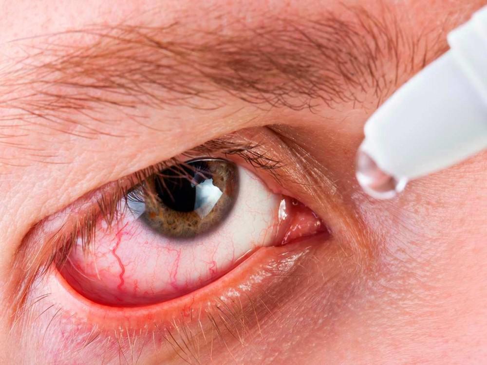 Dry Eyes Demystified: Accent Vision Specialists ...