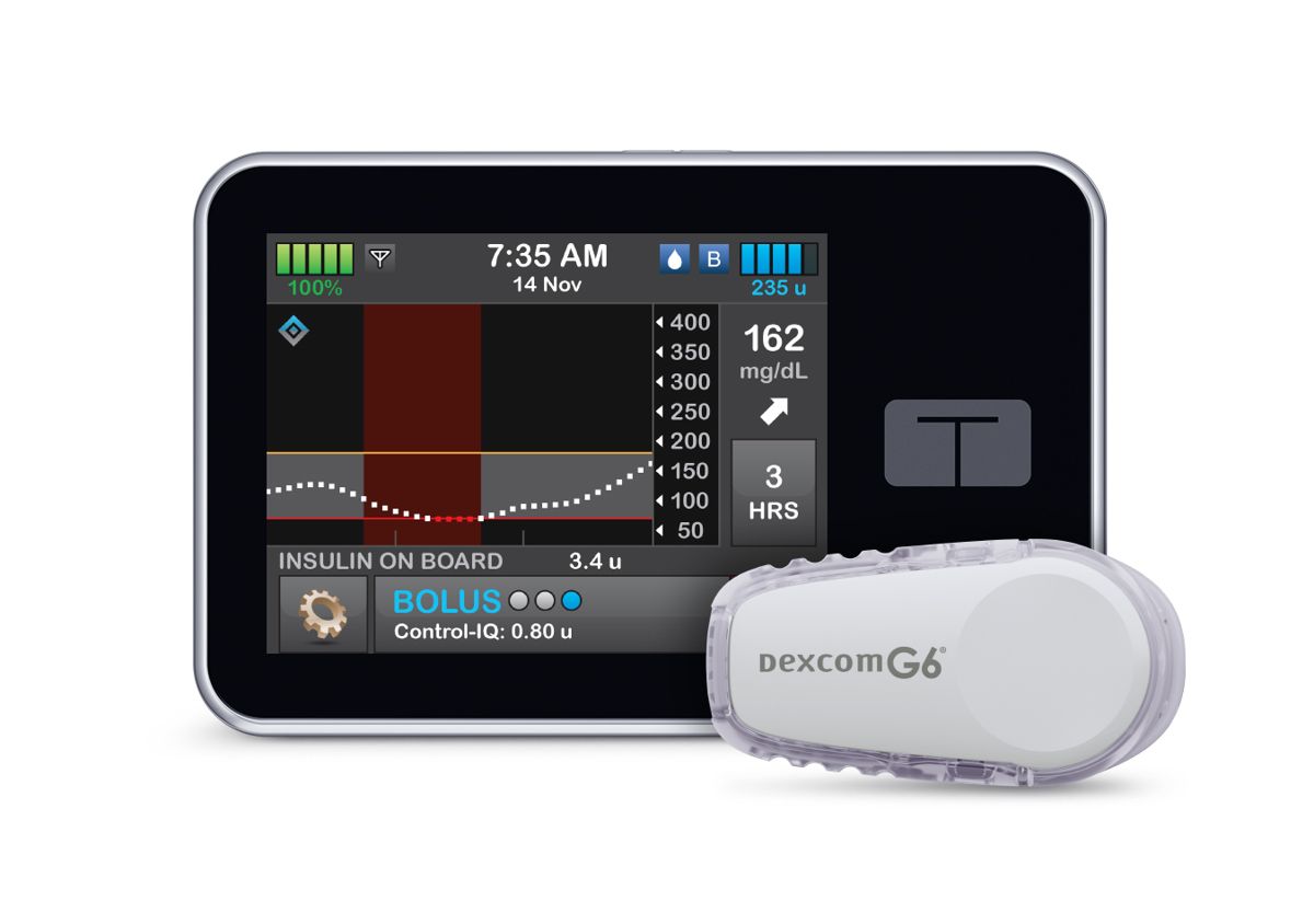FDA Approves An Interoperable, Automated Insulin Pump