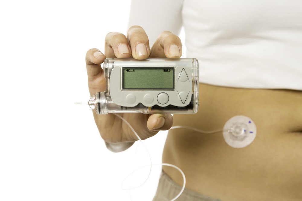 FDA Recommends Glucose Monitors, Insulin Pumps for Diabetes Management