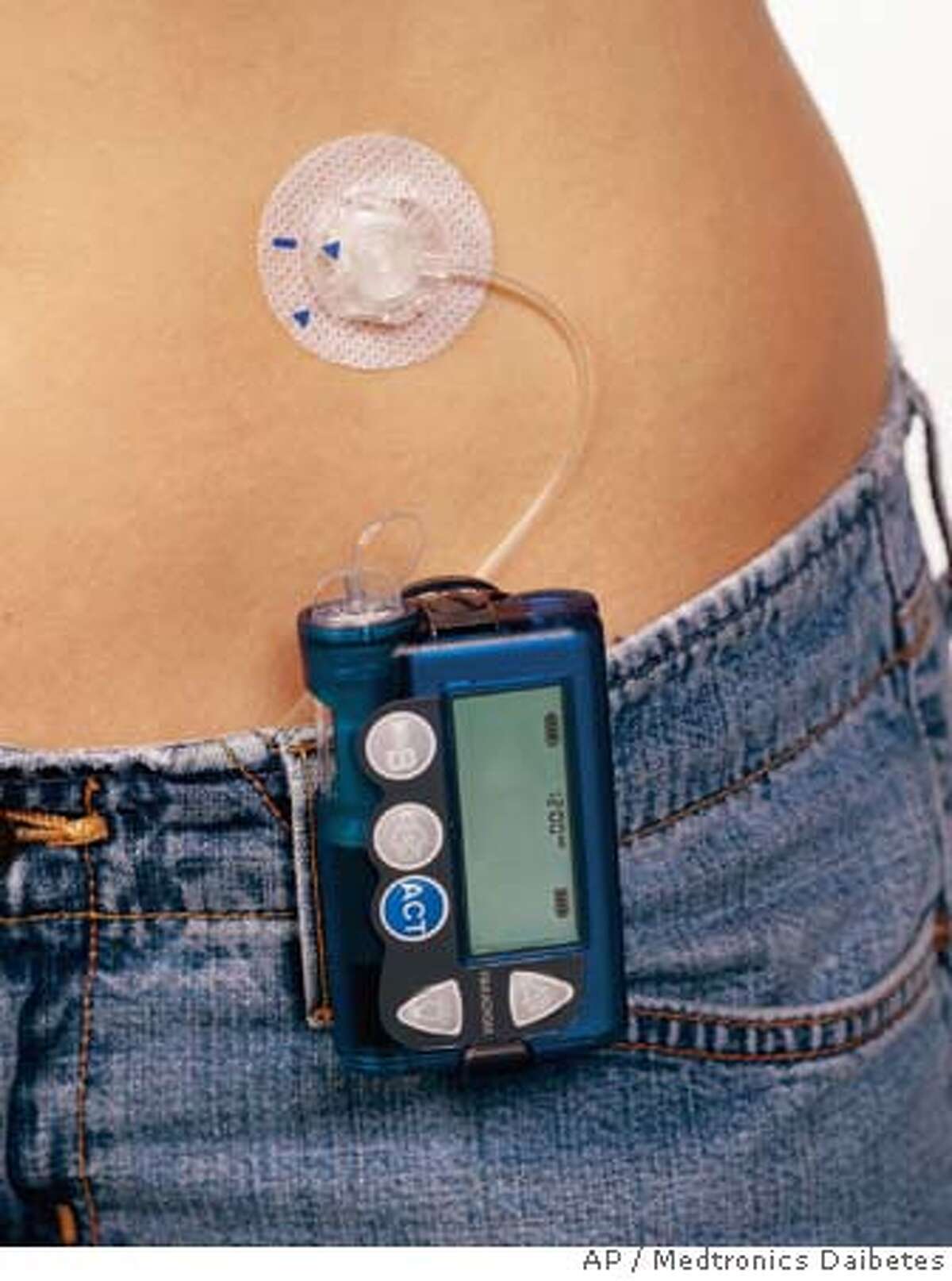 FDA warns that teens using insulin pumps may be too careless