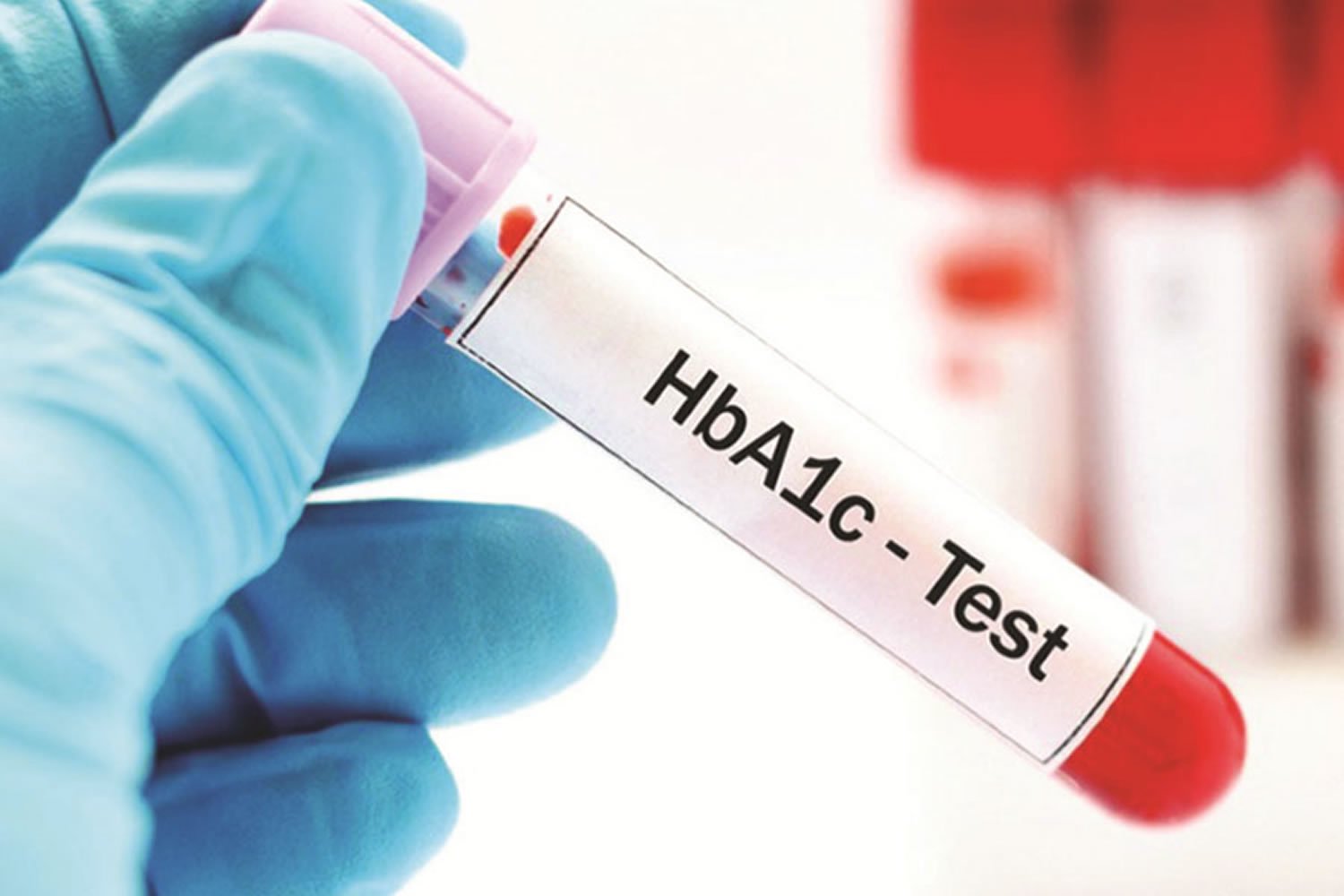 HbA1c chart, HbA1c test, normal HbA1c level and HbA1c range diabetes