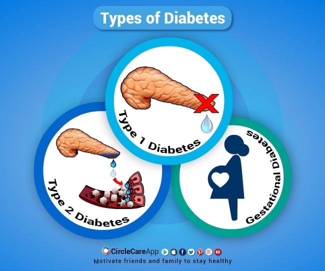 How many different types of diabetes are there?