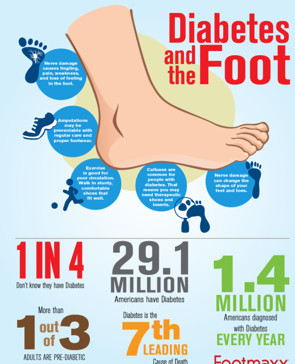 How to Care for Your Feet When You Have Diabetes