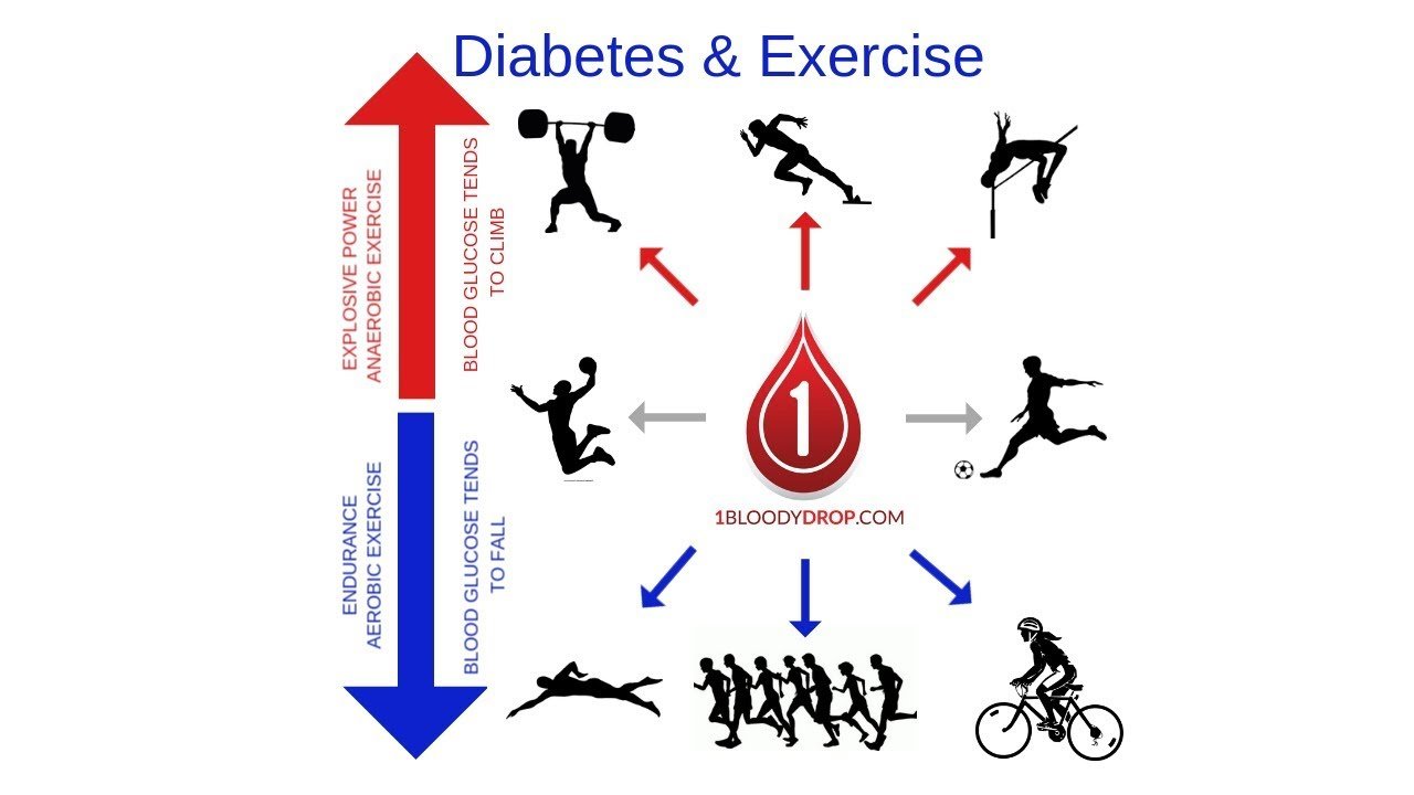 How to Exercise With Type 1 Diabetes