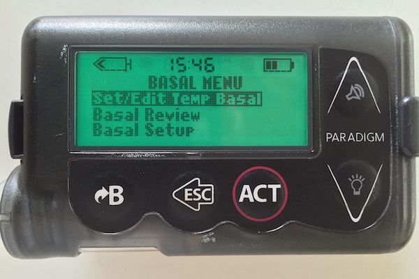 How To Make Basal Rate Testing Less Brutal