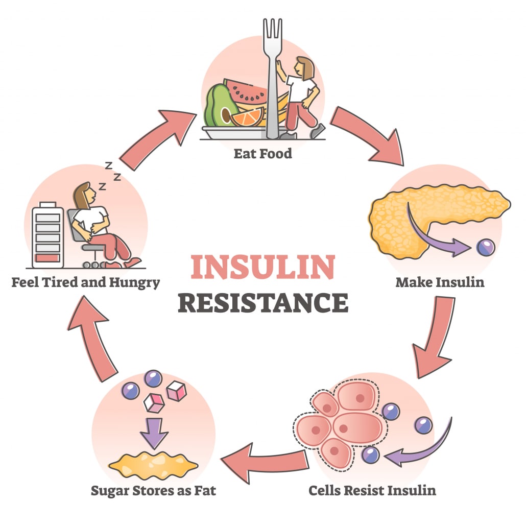Insulin Resistance and Infertility: What you Need to Know