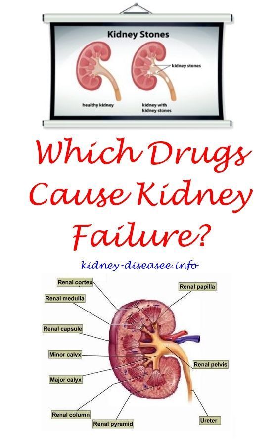 Kidney Cysts And Diabetes