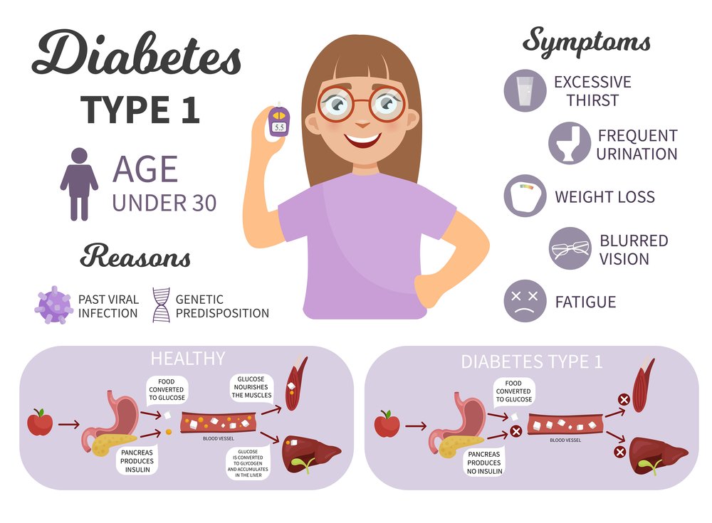 Latest Treatments for Type 1 Diabetes