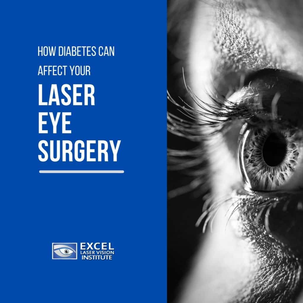Learn How Diabetes Can Affect Your Laser Eye Surgery from a LASIK ...