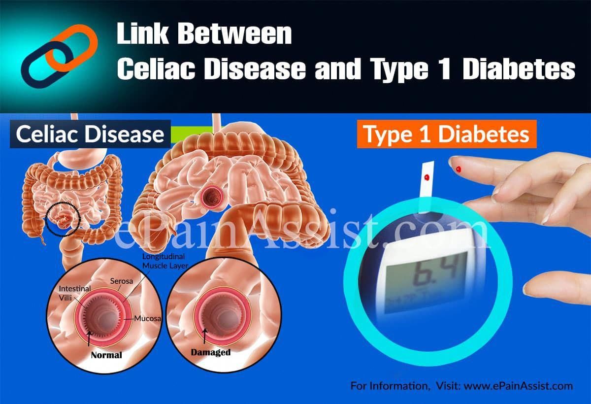 Link Between Celiac Disease and Type 1 Diabetes