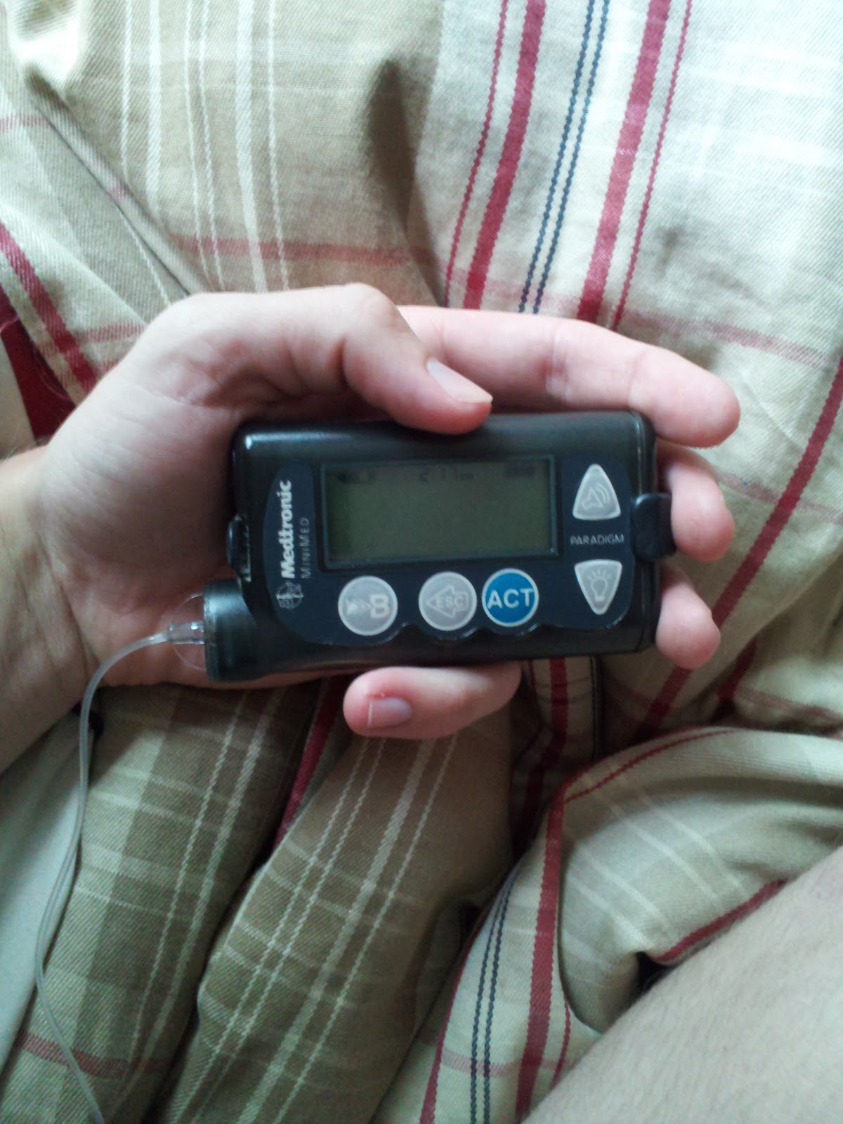 Living With Diabetes: I Go on the Insulin Pump