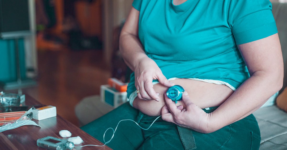 Medicare and Insulin Pumps: What You Need Know