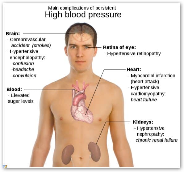 natural health supplement: High Blood Pressure Symptoms
