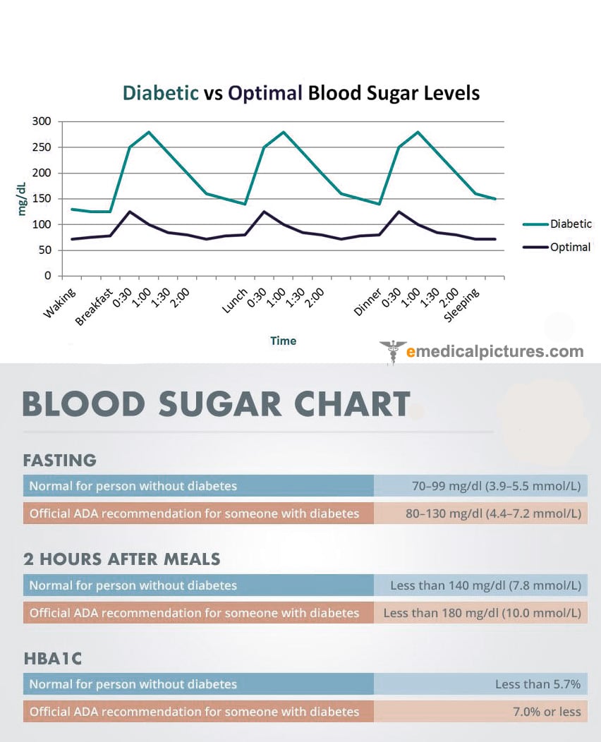 Normal blood sugar levels chart (comparison with diabetes)