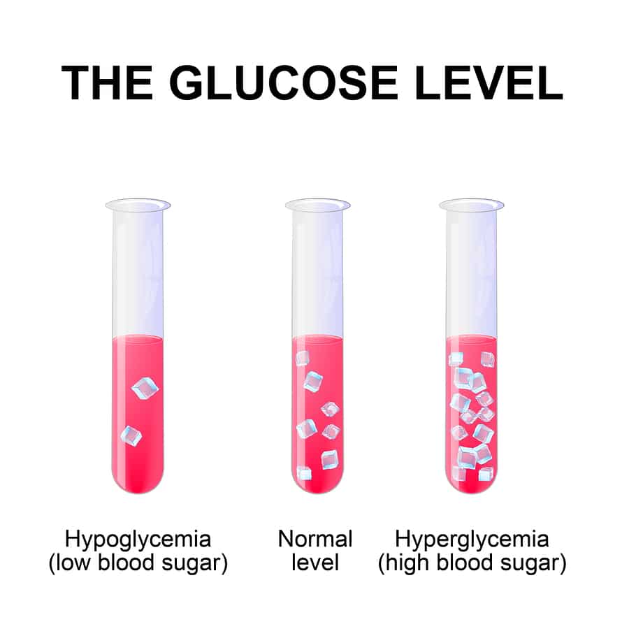 Normal Glucose Levels