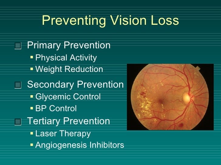 Preventing Vision Loss in Diabetic Retinopathy