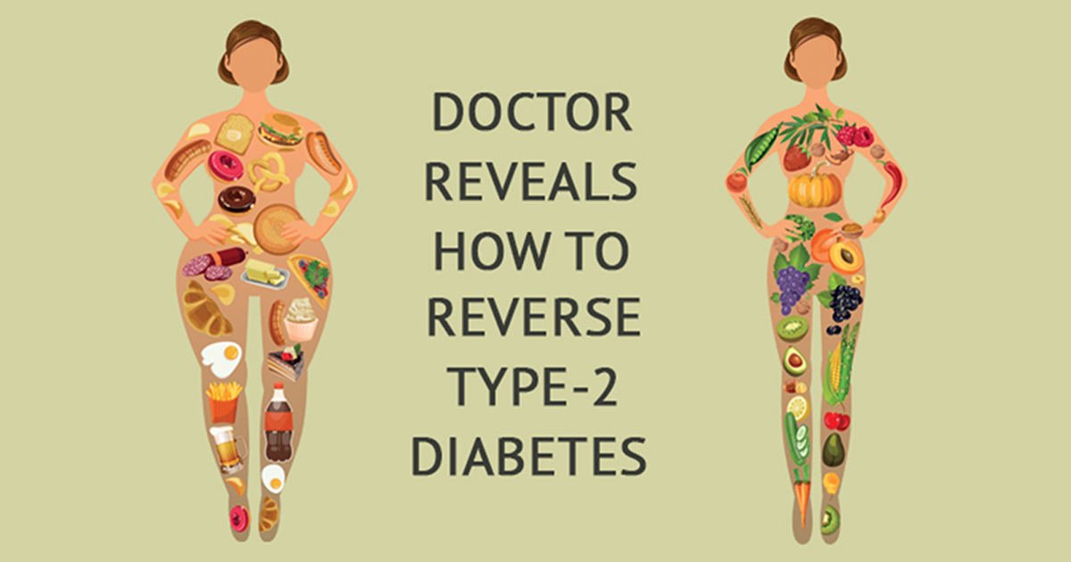 Reversing Type 2 Diabetes Naturally