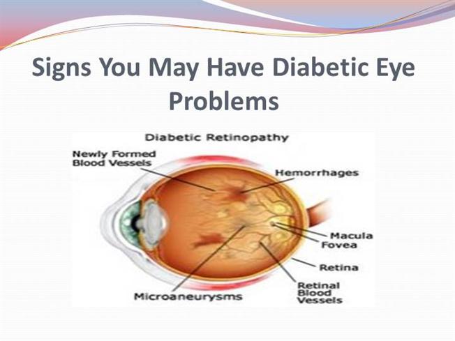 Signs You May Have Diabetic Eye Problems