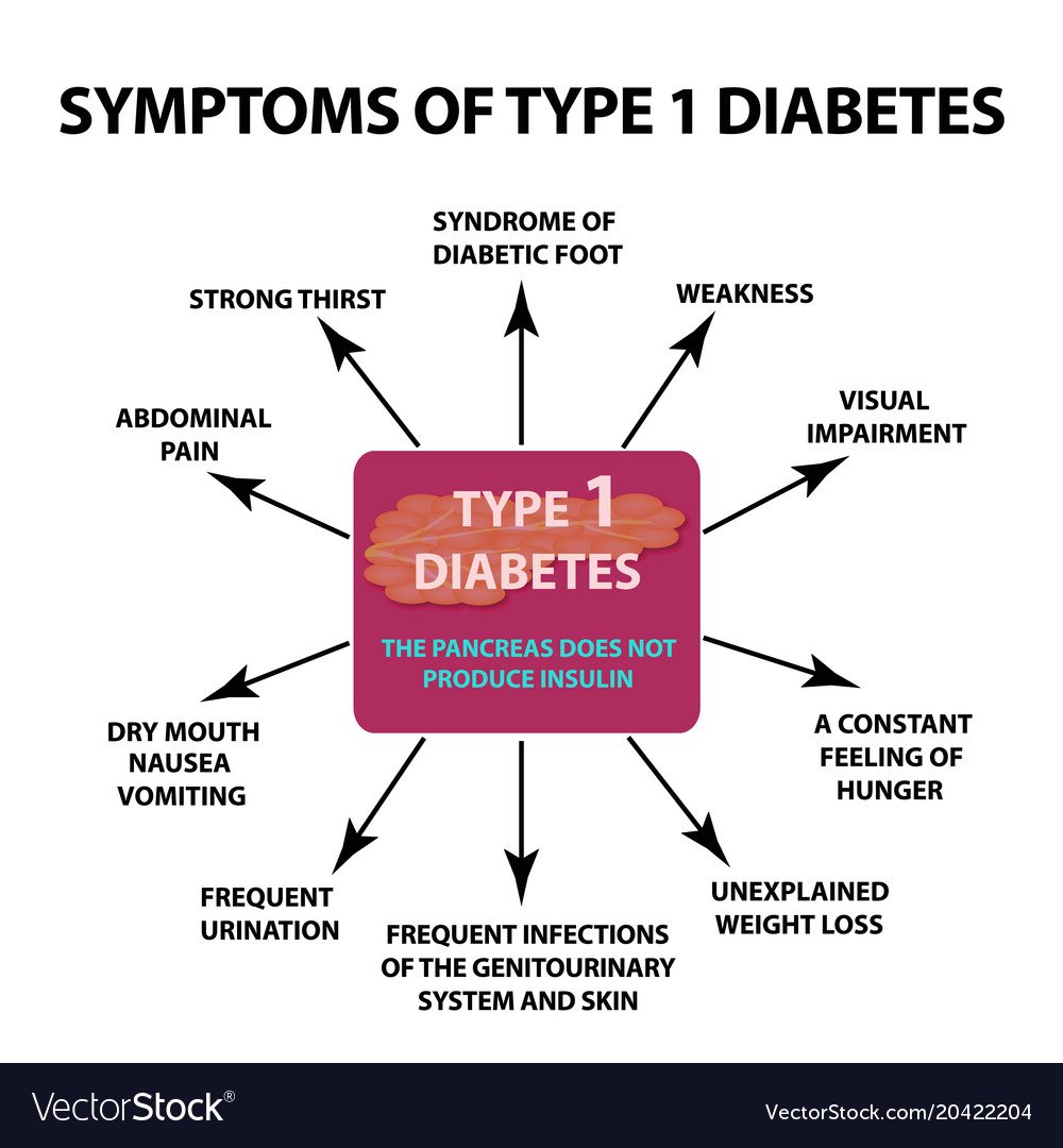 Symptoms type 1 diabetes infographics Royalty Free Vector
