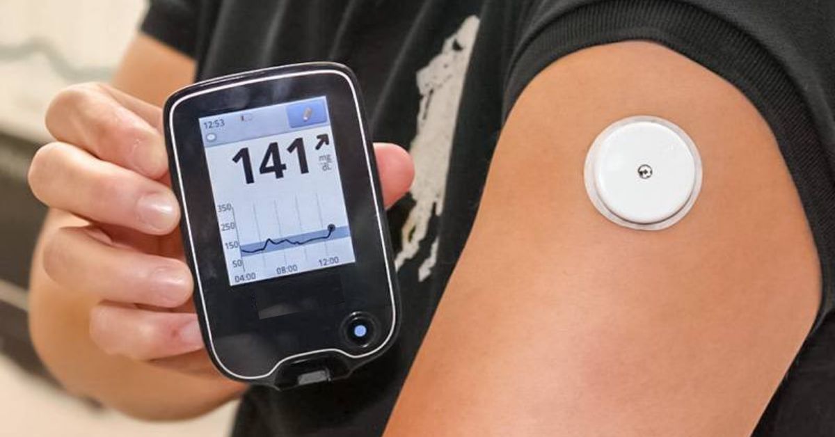 The Continuous Glucose Monitor (CGM) Guide