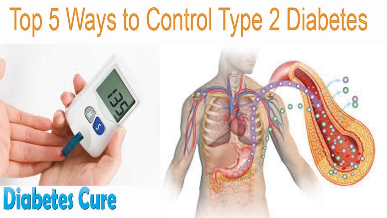 Top 5 Ways to Control Type 2 Diabetes