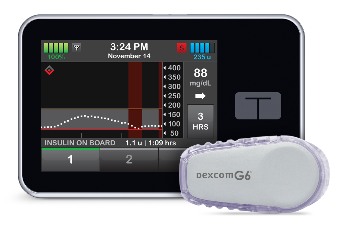 t:slim X2 insulin pump first to receive new ACE pump classification by ...