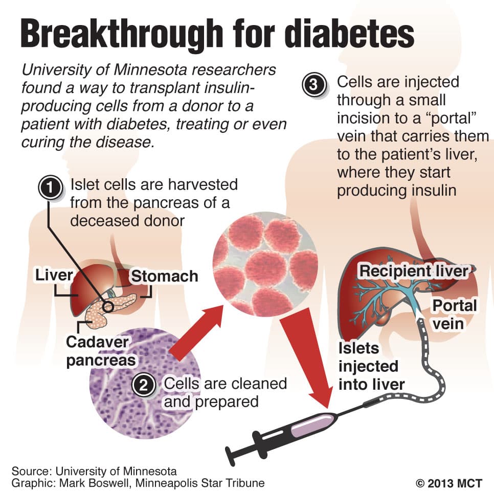 type 1 diabetes cure ~ health articles