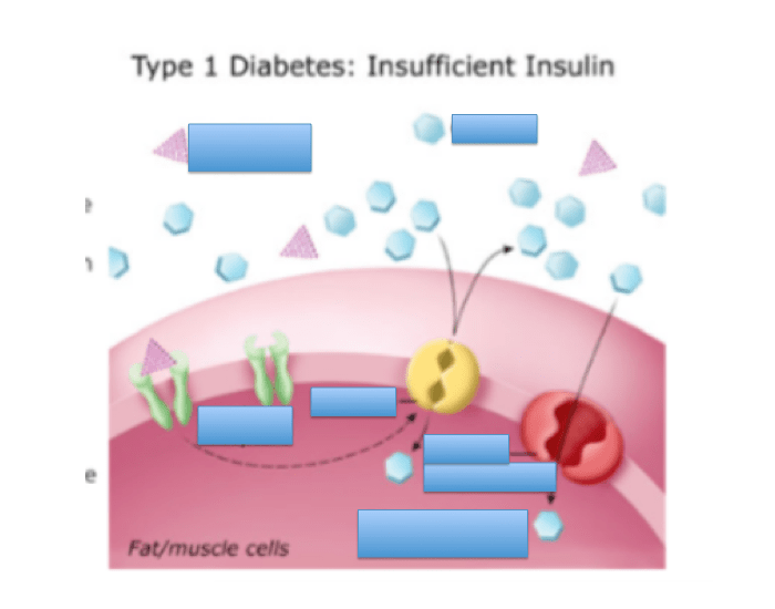 Type 1 Diabetes: Insufficient Insulin Quiz