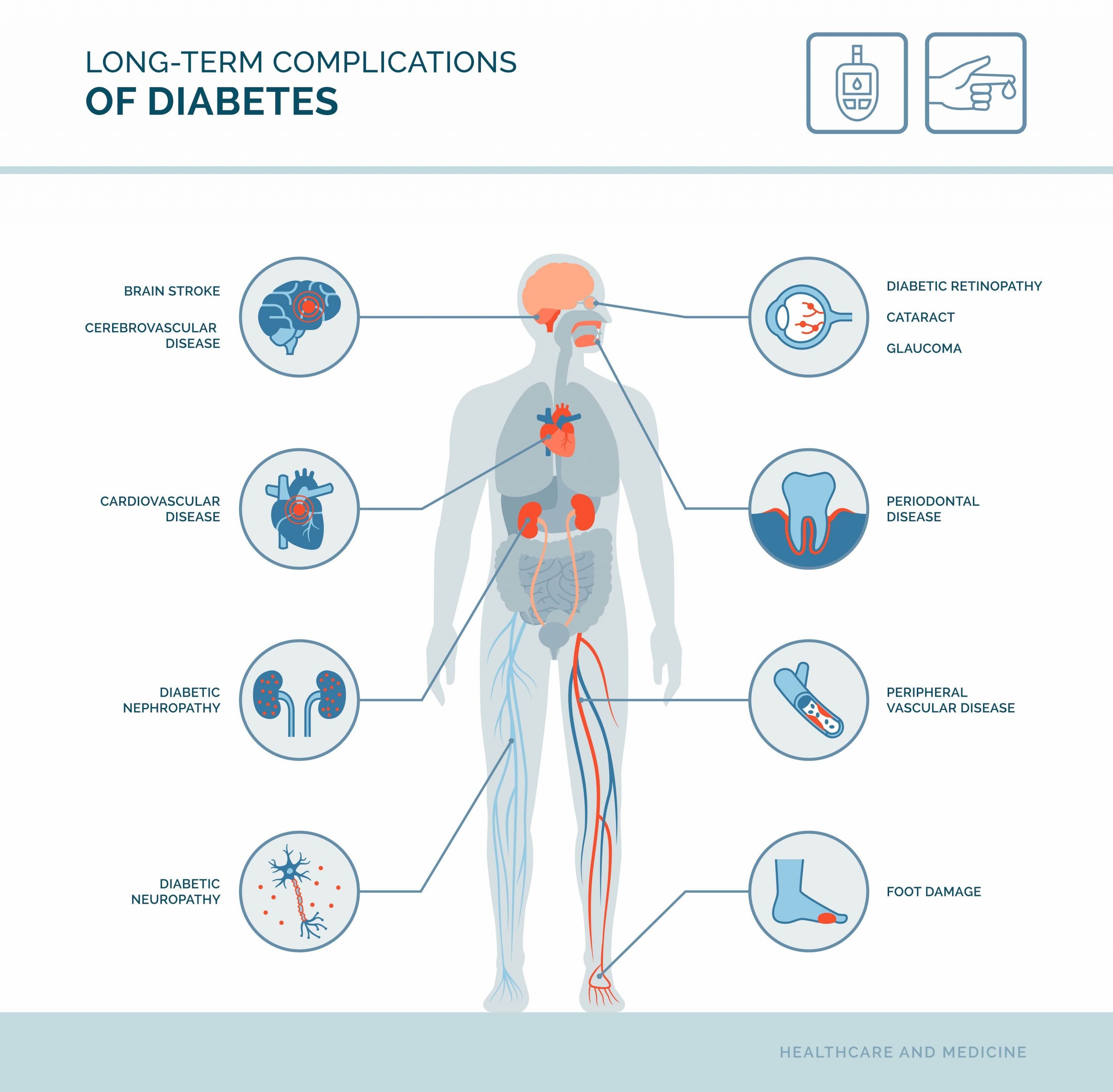 Type 2 Diabetes Complications: Overview and More