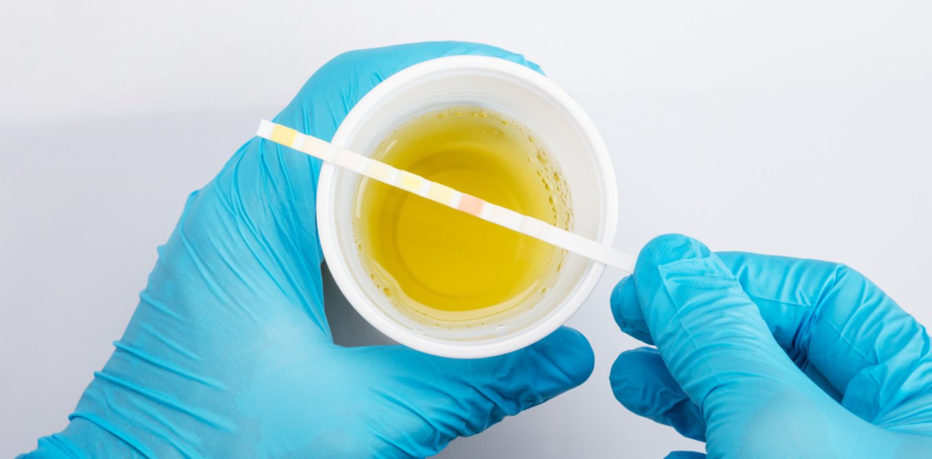 What can your doctor tell from your urine?