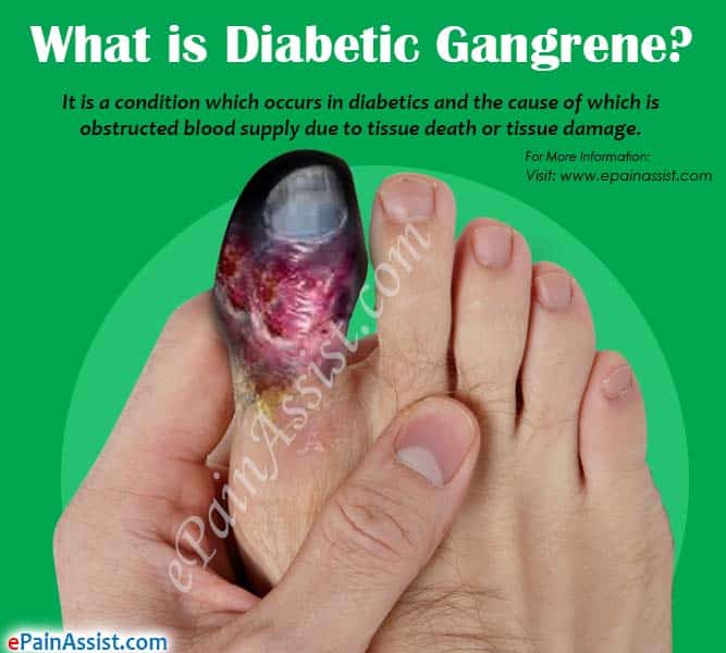 What is Diabetic Gangrene