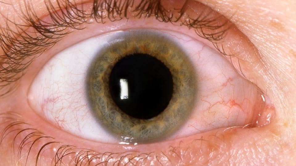 Youngsters with diabetes more at risk of eye disease ...